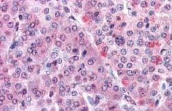 MLEC Antibody, Novus Biologicals 50 &mu;g | Buy Online | Novus Biologicals | Fisher Scientific